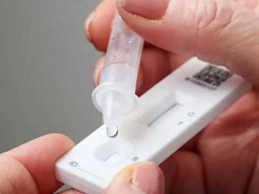 抗原检测商标分类属于第几类-抗原检测商标注册属于哪一类？